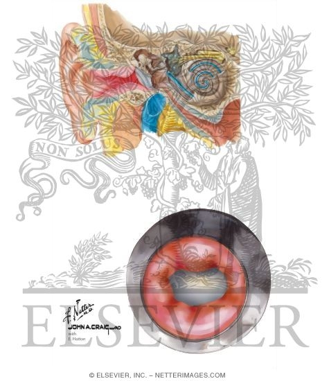 Acute Otitis Externa