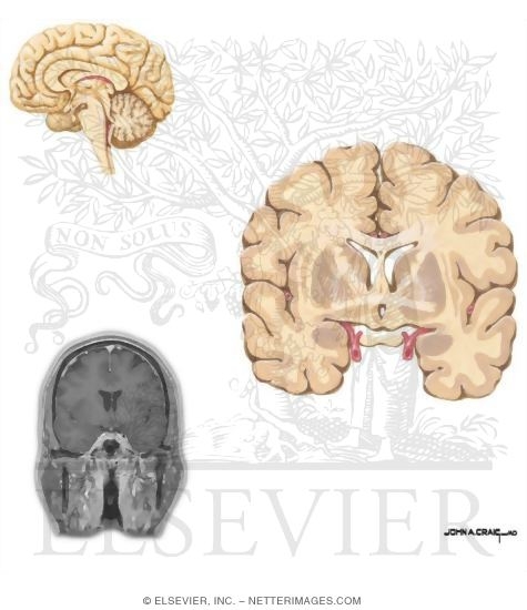 Coronal Sections Through the Forebrain: Anterior Commissure / Columns of Fornix