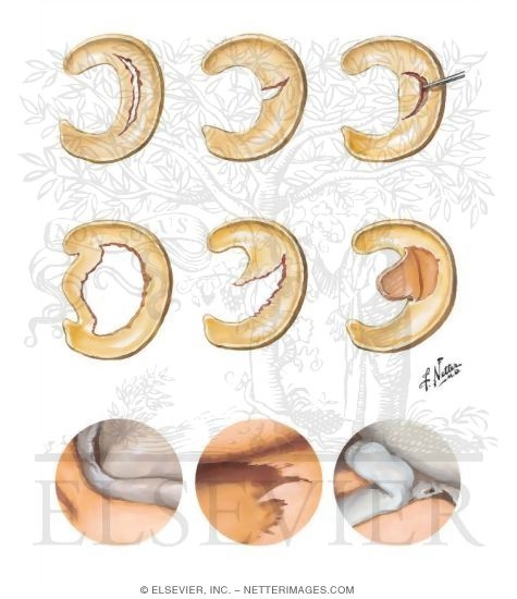 Watermarked preview of unlabeled image: Disorders of the Leg and Knee