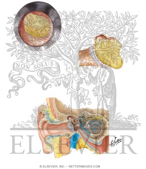 Otitis Media