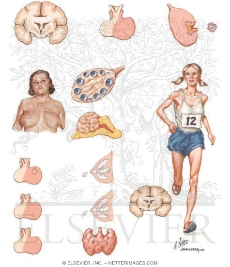Causes of Ovulatory Dysfunction