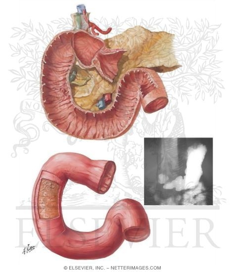 Mucosa and Musculature of Duodenum