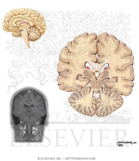 Coronal Sections Through the Forebrain: Caudal Pulvinar and Superior Colliculus