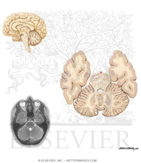 Horizontal Sections Through the Forebrain: Rostral Pons