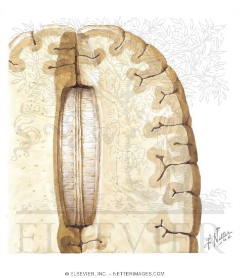 Corpus Callosum: Horizontal View