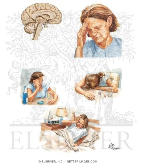 Depression (Unipolar)