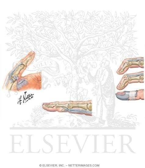 Watermarked preview of unlabeled image: Disorders: Ligament Injuries
