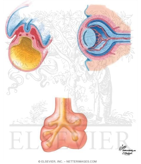 Watermarked preview of unlabeled image: Induction