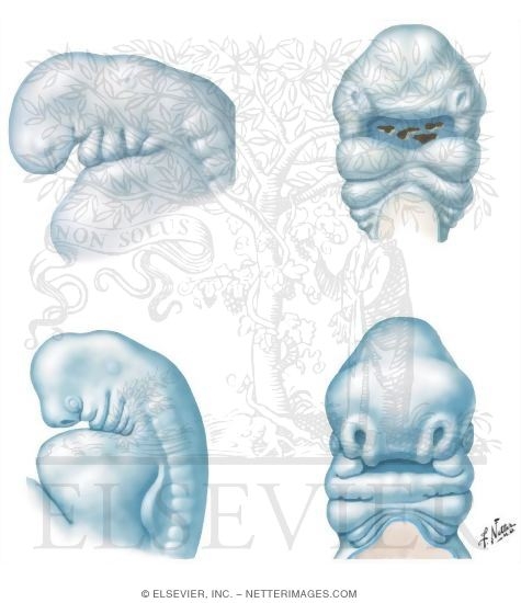 Watermarked preview of unlabeled image: Development of the Face: 4 to 6 Weeks
