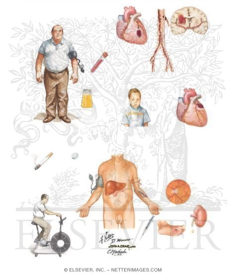 Watermarked preview of unlabeled image: Cardiovascular Disease in Diabetes