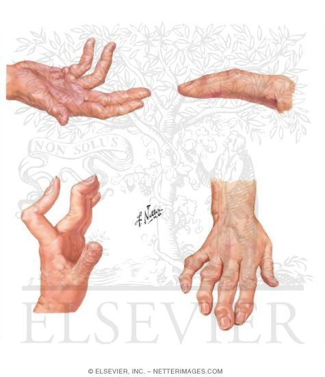 Watermarked preview of unlabeled image: Physical Examination of the Hand