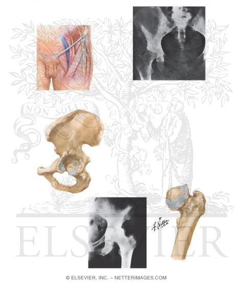 Watermarked preview of unlabeled image: Disorders of the Thigh and Hip