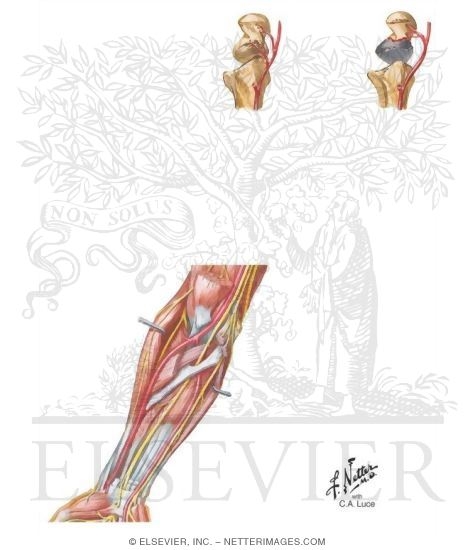 Arteries of the Forearm