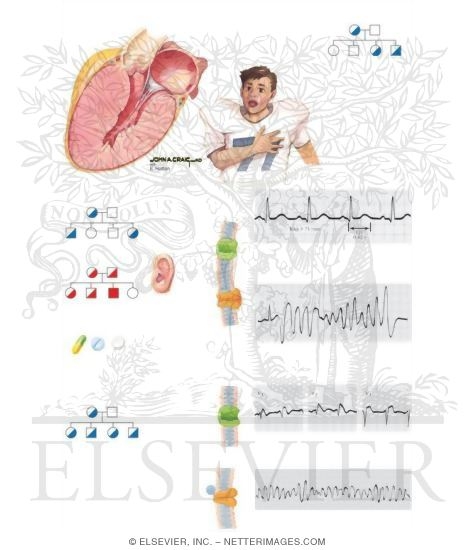 Watermarked preview of unlabeled image: Sudden Cardiac Death