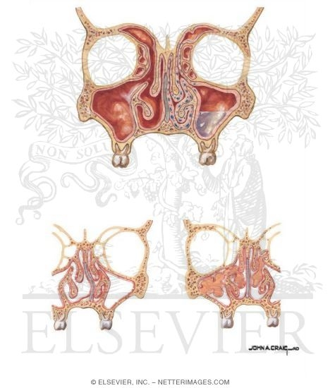Histology and Physiology of Nasal Cavity and Sinuses