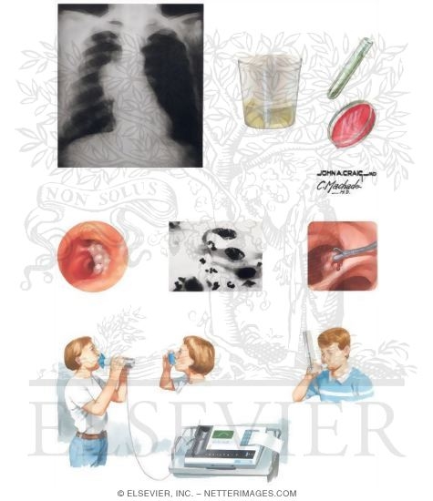 Watermarked preview of unlabeled image: Diagnostic Testing In Chronic Cough