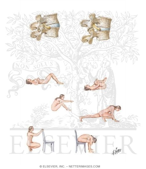 Watermarked preview of unlabeled image: Low Back Pain
