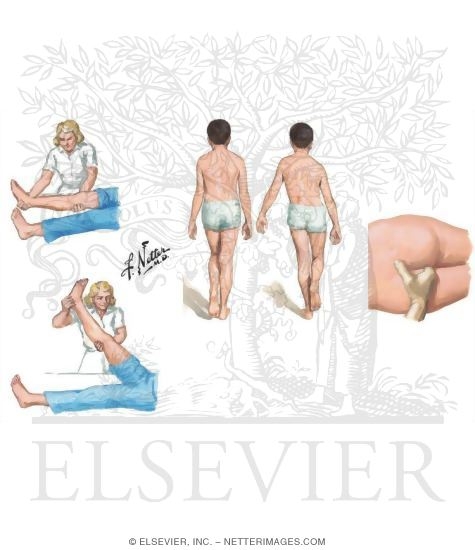 Watermarked preview of unlabeled image: Physical Exam of the Pelvis