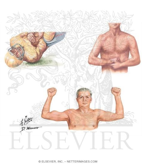 Watermarked preview of unlabeled image: Medical History of the Shoulder
