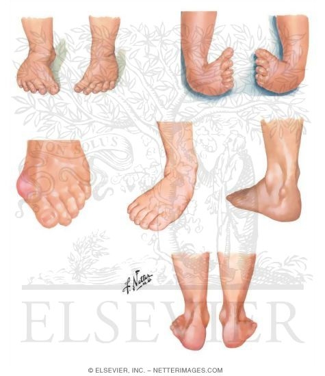 Physical Exam of the Foot and Ankle
