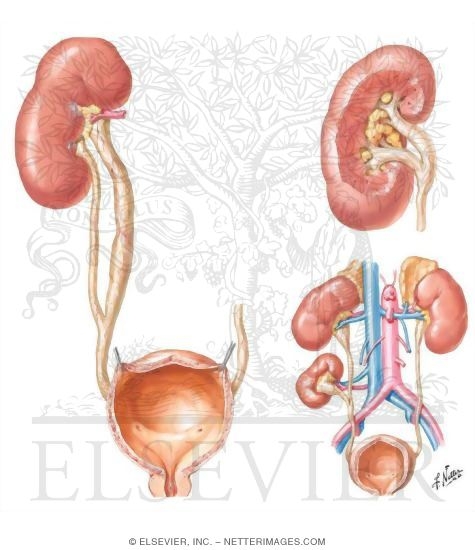 Watermarked preview of unlabeled image: Ureteric Bud Duplication