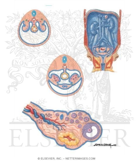Watermarked preview of unlabeled image: Embryologic Origins of Ovarian Cancer