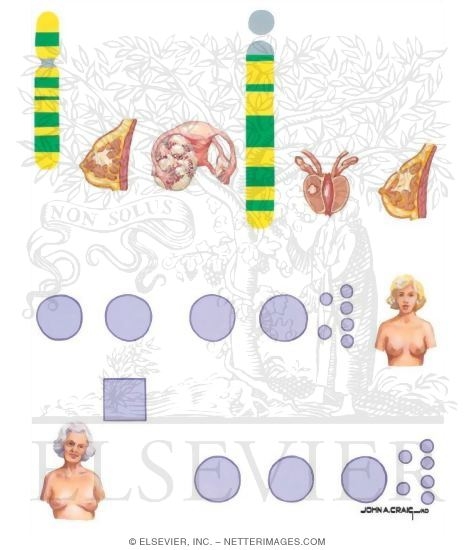 Watermarked preview of unlabeled image: Genetics in Familial Breast Cancer
