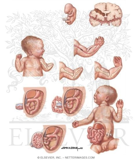 Watermarked preview of unlabeled image: Vascular Etiology of Anomalies