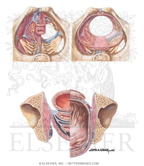 Watermarked preview of unlabeled image: Vaginal Childbirth and Pelvic Damage