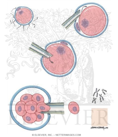New Techniques in Fertilization