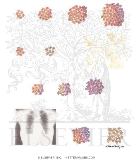 Watermarked preview of unlabeled image: Tumor Biology and Chemotherapy
