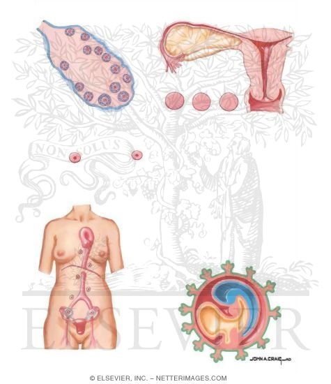 Watermarked preview of unlabeled image: Germ Cell Ovarian Cancer