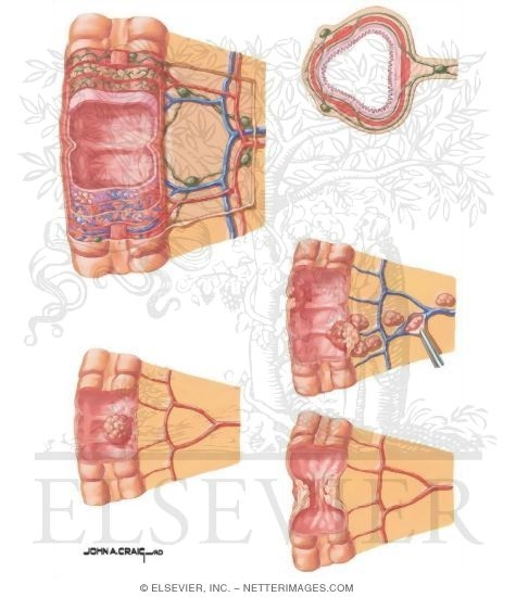 Watermarked preview of unlabeled image: Vascular and Lymphatic Architecture of Colon Wall 
