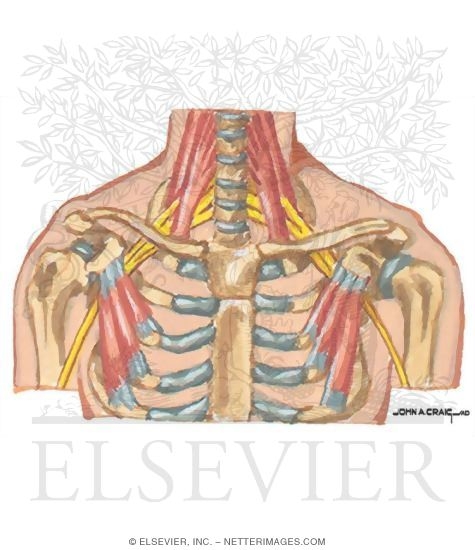 Watermarked preview of unlabeled image: Thoracic Outlet Syndrome: Brachial Plexopathy