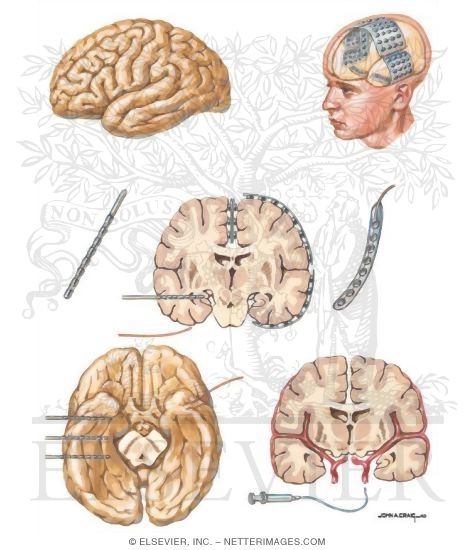 Watermarked preview of unlabeled image: Preoperative Evaluation