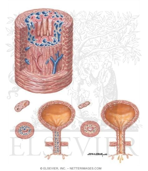 Urethral Mucosal Coaptation