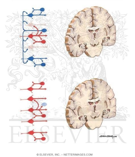 Origin and Spread of Seizures