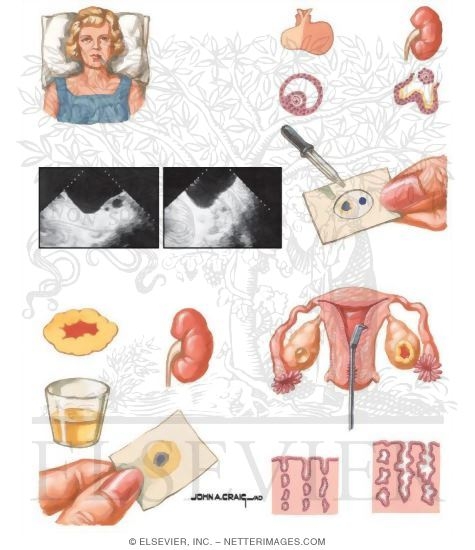 Watermarked preview of unlabeled image: Assessment of Ovulation