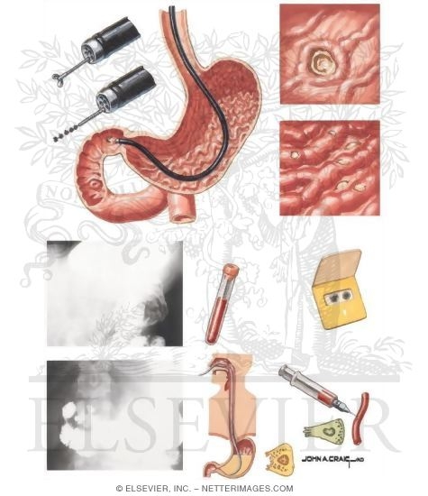 Diagnostic Evaluation 