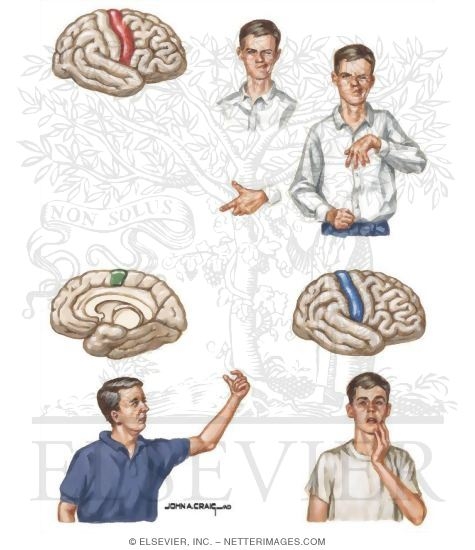 Partial Motor and Somatosensory Seizures