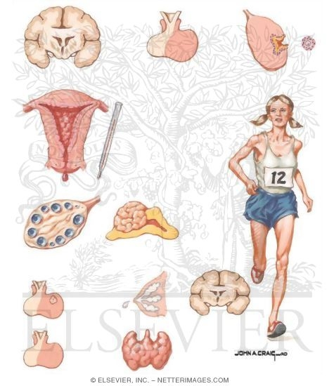 Causes of Ovulatory Dysfunction