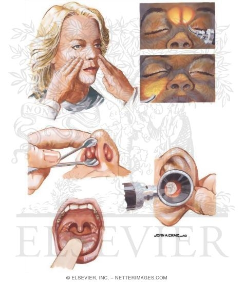 Physical Examination of the Nasal Cavity