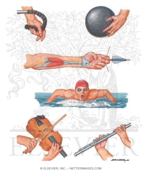 Watermarked preview of unlabeled image: Compression Neuropathy in Athletes and Musicians