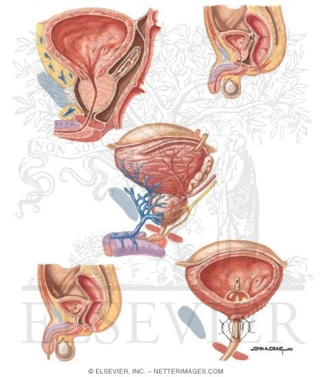 Watermarked preview of unlabeled image: Radical Prostatectomy
