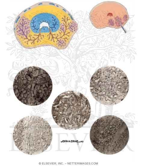 Watermarked preview of unlabeled image: Prostate Cancer