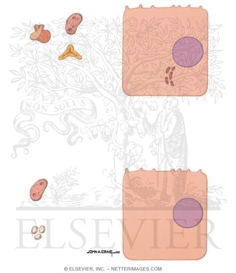 Watermarked preview of unlabeled image: Hormonal Influences in Breast Cancer