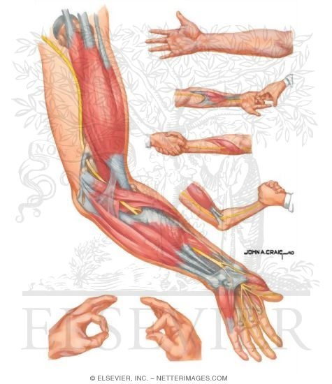 Watermarked preview of unlabeled image: Proximal Compression of Median Nerve