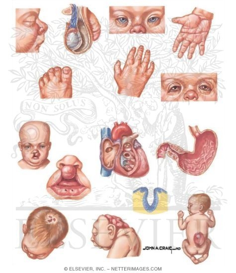 Watermarked preview of unlabeled image: Normal versus Major versus Minor Malformations