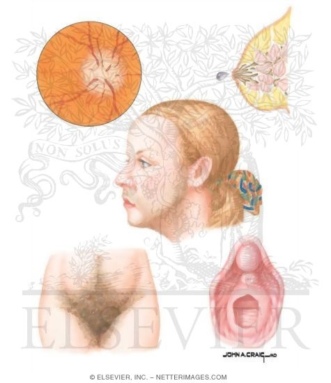Watermarked preview of unlabeled image: Clinical Findings in Female Infertility 