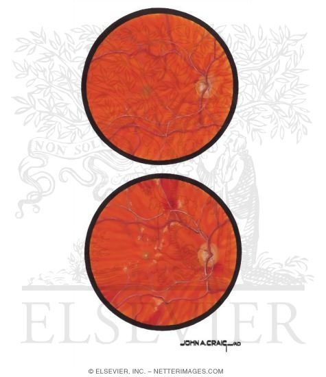 Watermarked preview of unlabeled image: Optic Disc